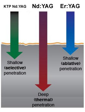 wavelength_penetration