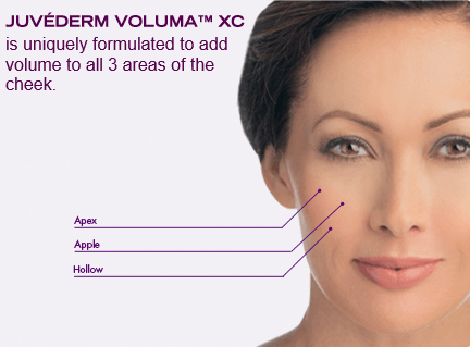 volumaXC