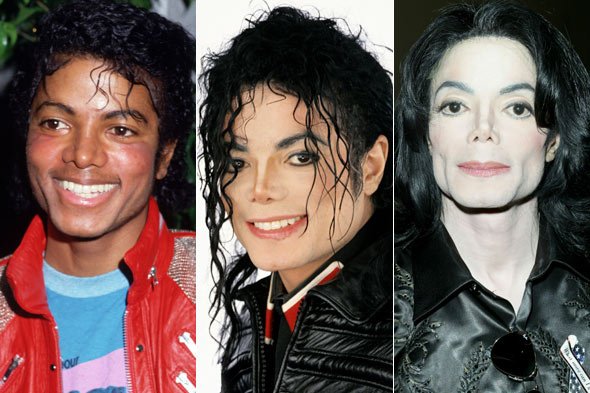 michael-jackson-plastic-surgery-590jn111010