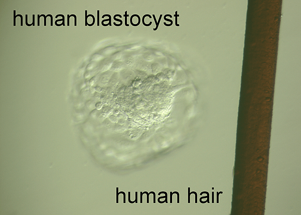 human_blastocyst_hair_scale