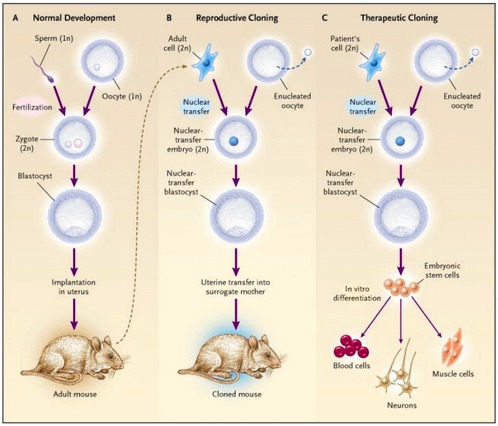 NEJM