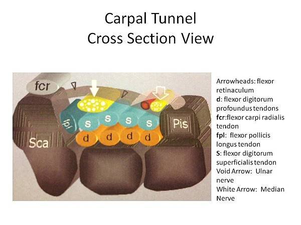 carpal-tunnel-illustration