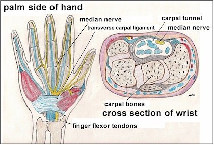 carpal-tunnel-syndrome