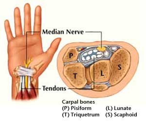 WristCrossSectionShowingCarpalTunnel