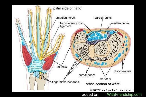 Carpal-Tunnel-Syndrome-picture