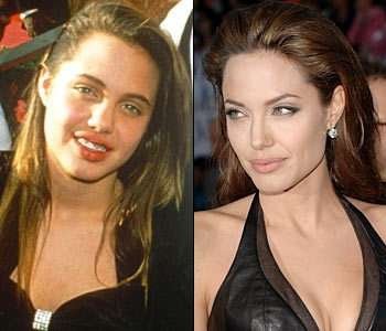 angelina-jolie-nose-job-before-and-after