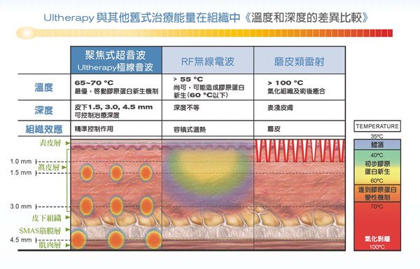 Ultherapy123_ 內頁_副本