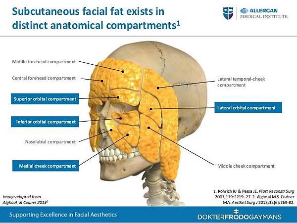 training-for-periorbital-and-upper-face-treatment-with-botox-and-juvederm-8-638