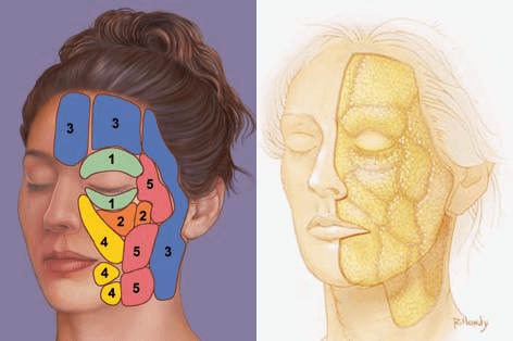 Fat-compartments-to-be-injected-by-facial-fillers-in-Charlotte