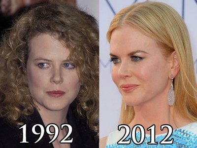 Nicole-Kidman