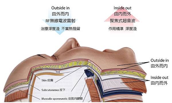 極限音波拉皮-由內而外 