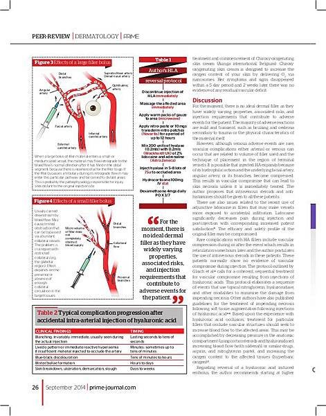 reversal-of-a-hla-dermal-filler-induced-facial-artery-occlusion-5-638