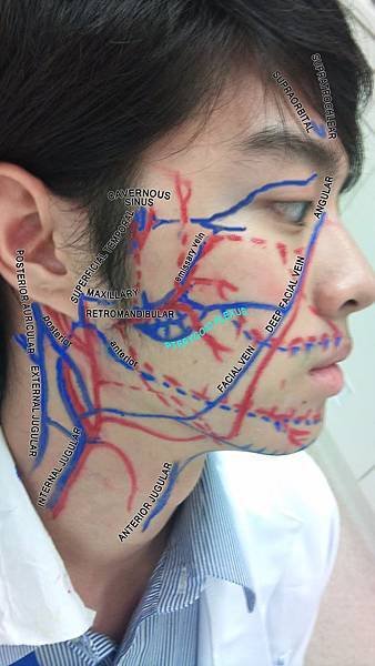 TGN Artery + Vein labelled