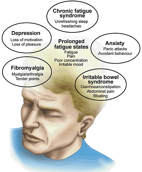 chronic_fatigue_syndrome.304115545_std-1