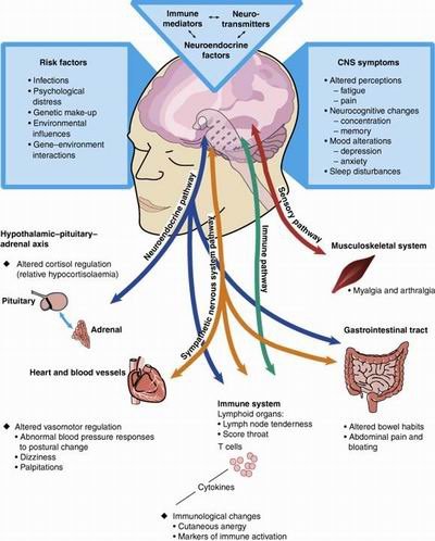 Chronic-fatigue-syndrome