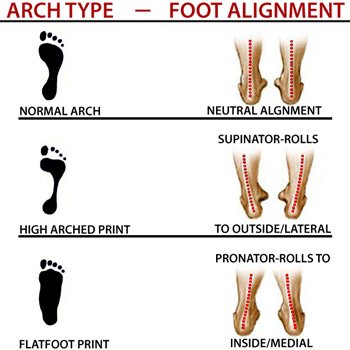 higharch