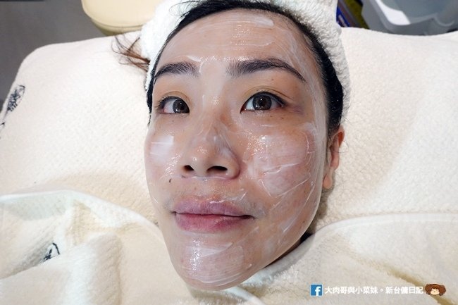 修復 竹北微依美精品醫美診所 皮秒  除斑  竹北醫美推薦 新竹醫美 皮秒蜂巢雷射 (5).JPG