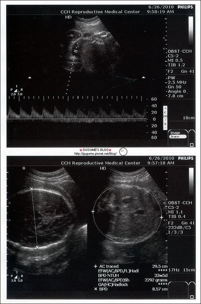 bb-33w5d.jpg