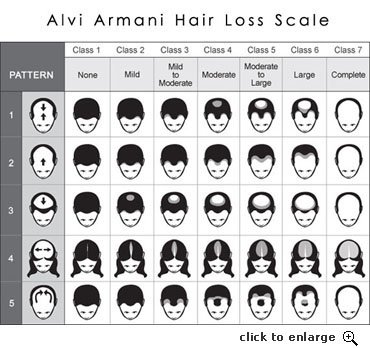 alviarmani_hairloss_scale_thumbnail