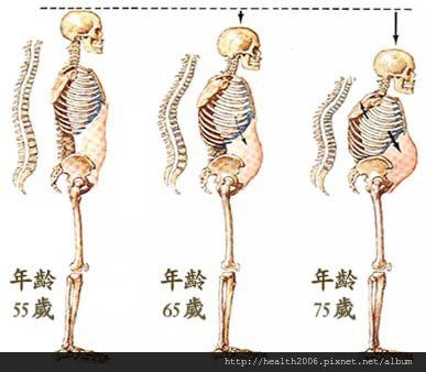 55.63.75歲的骨頭發展