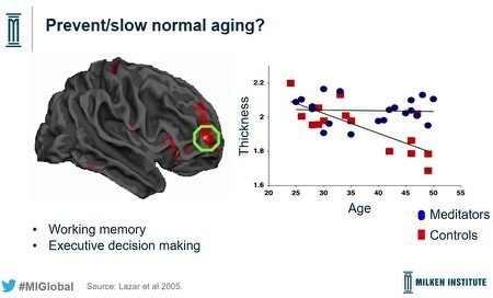 【氣功養生】哈佛神經學家：打坐8週 大腦結構獲改善