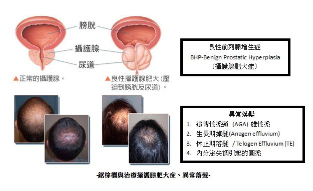 【探討】鋸棕櫚 對人類的好處