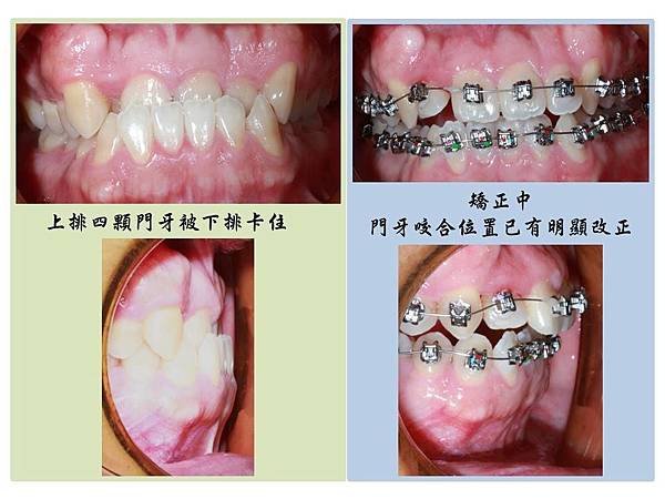投影片3.JPG