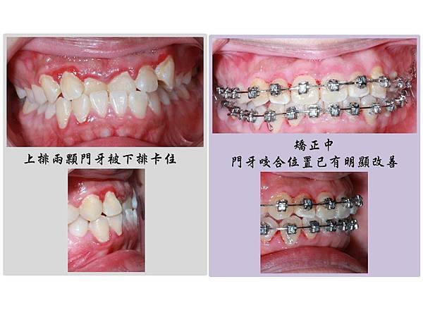 投影片4.JPG