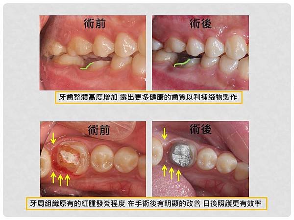 投影片6.JPG