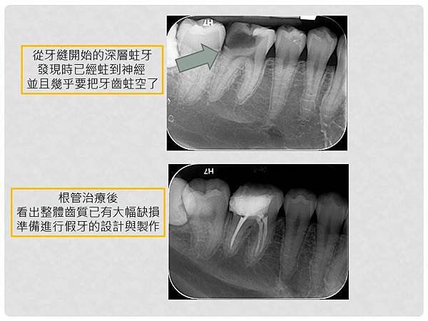 投影片3.JPG
