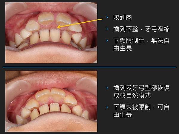 投影片10.JPG