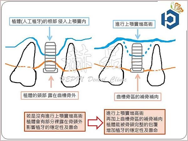 投影片3.JPG