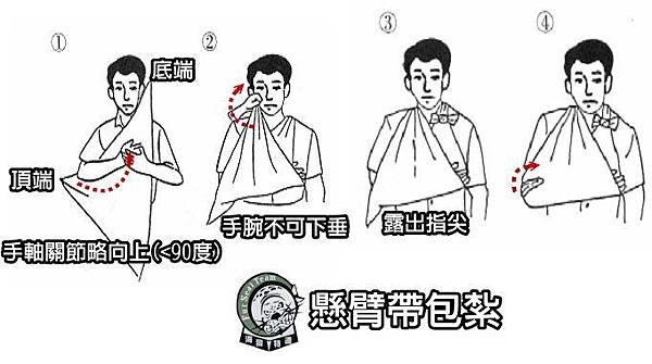 懸臂帶包紮