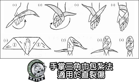 手掌三角巾包紮法-直裂