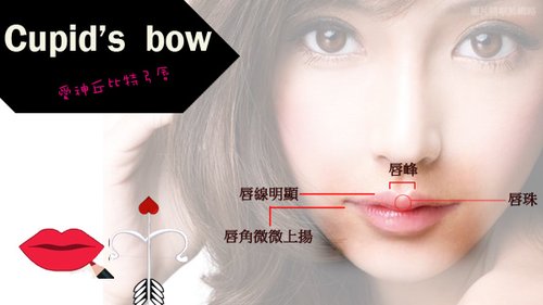 玻尿孫豐唇丘比特弓唇05