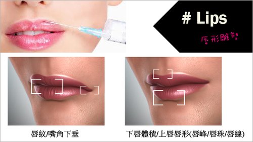 改善問題