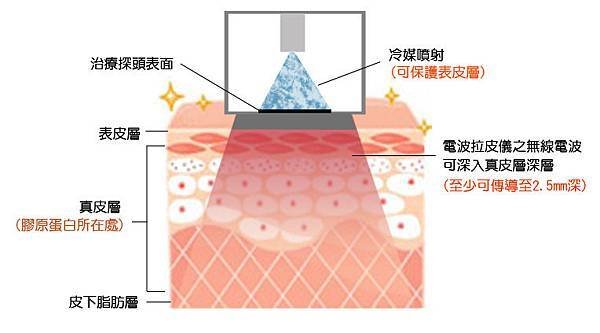 光纖粉餅雷射蘋果肌玻尿酸3D聚左旋乳酸電波拉皮微晶瓷瓜子臉CPT電波拉皮維納斯曲線電波4D羽毛線拉提14.jpg