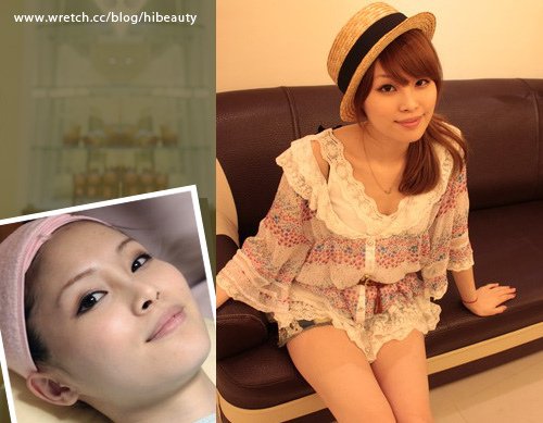 杏仁酸 推薦 杏仁酸 粉刺 水涵氧 價格 光纖粉餅雷射 價格 光纖粉餅雷射 痘疤 美麗晶華 光纖粉餅雷射 維納斯曲線電波 抽脂 減肥 塑身 Ultrashape標靶震波溶脂 標靶震波溶脂 推薦 標靶震波溶脂 價錢 標靶震波溶脂 價格 12.jpg