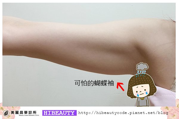 標靶震波溶脂 費用 標靶震波溶脂  價格 標靶震波溶脂  手臂 標靶震波溶脂 效果 標靶震波溶脂 美麗晶華診所 推薦 美麗晶華 標靶震波溶脂 02.jpg