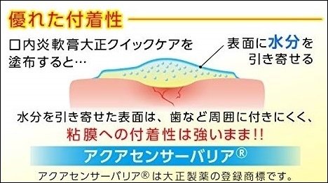 嘴破 口內炎的救星_日本 大正製藥 口內炎軟膏「黃色加強版」