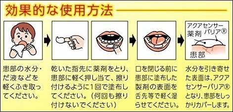 嘴破 口內炎的救星_日本 大正製藥 口內炎軟膏「黃色加強版」