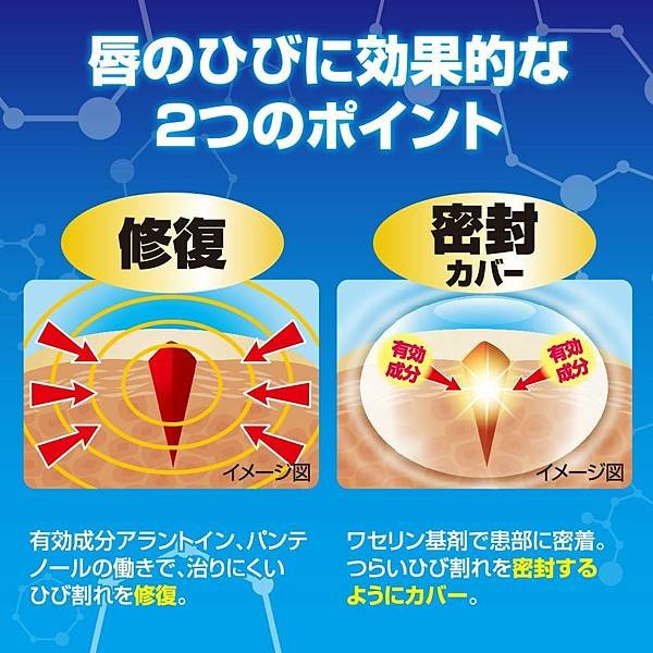 ロート_嘴唇乾裂和口角炎軟膏