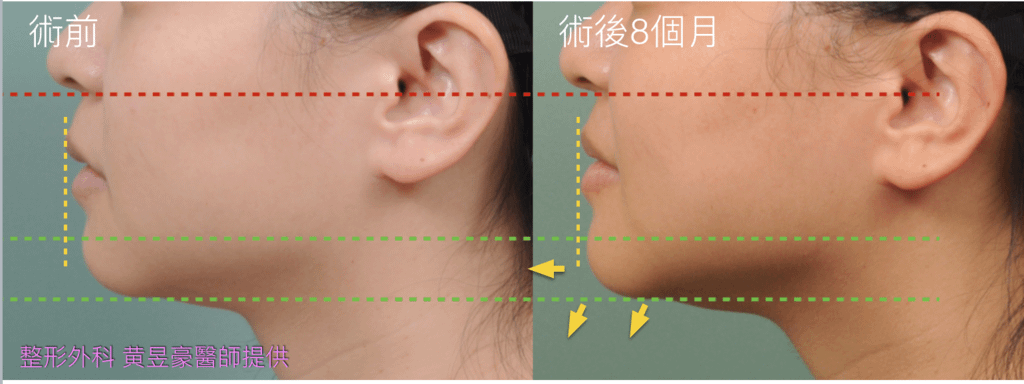 螢幕快照 2016-12-06 上午10.25.21.png