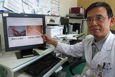 腹腔鏡微創手術頑固疝氣的新選擇