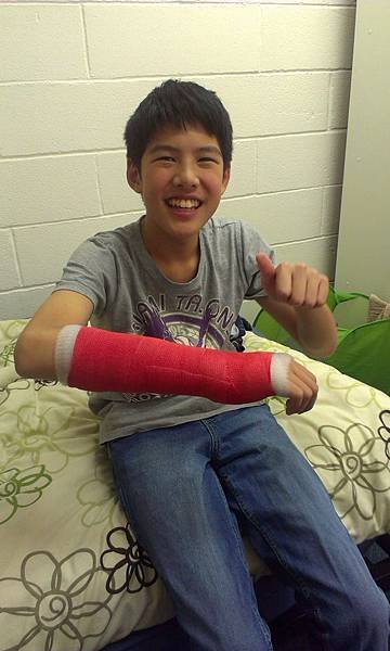 broken arm