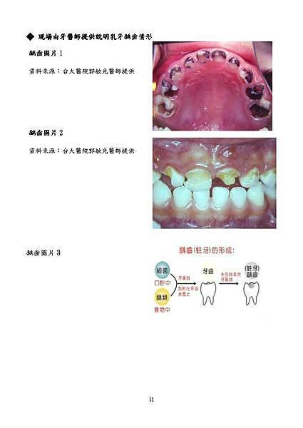 新聞稿刷了再睡從齒健康附件_頁面_5