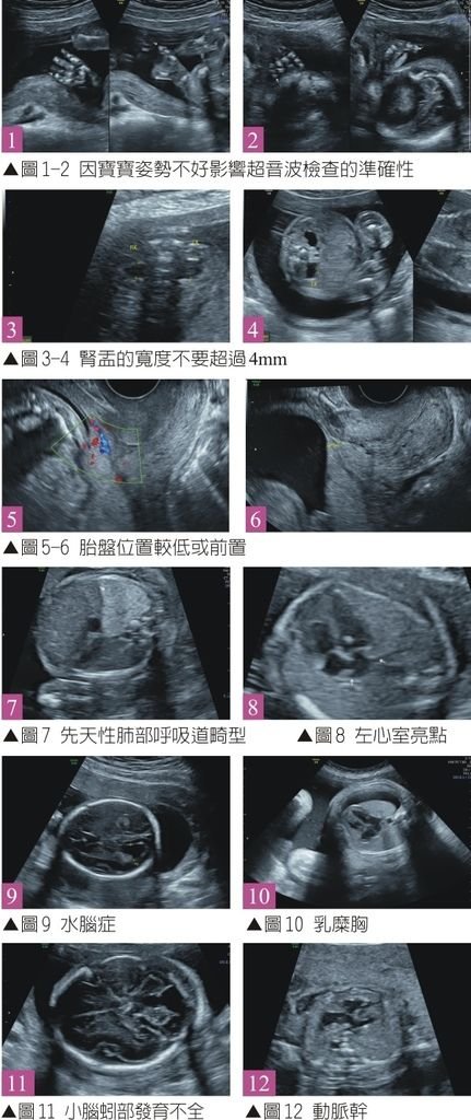 高層次超音波檢查內容2.jpg