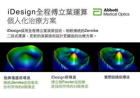 iDesign、第七代iLASIK、七D、七次元、視保眼科、鄭英明醫師、近視雷射、雷射近視、眼睛雷射、iLASIK