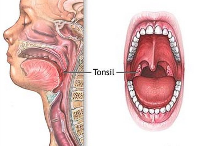 Tonsils