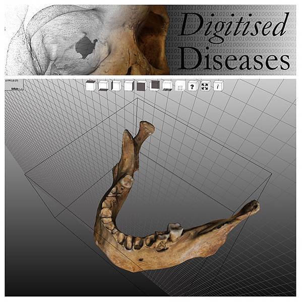 Digitised Diseases